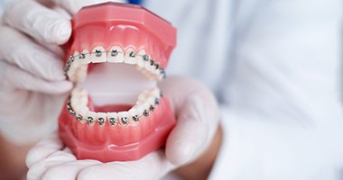 closeup of traditional braces in Medford