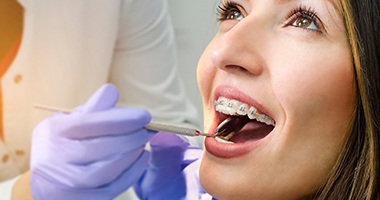 woman smiling during orthodontic checkup