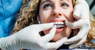 a dentist showing a patient how to use their Invisalign aligners 