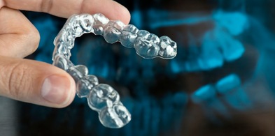 A clear plastic aligner