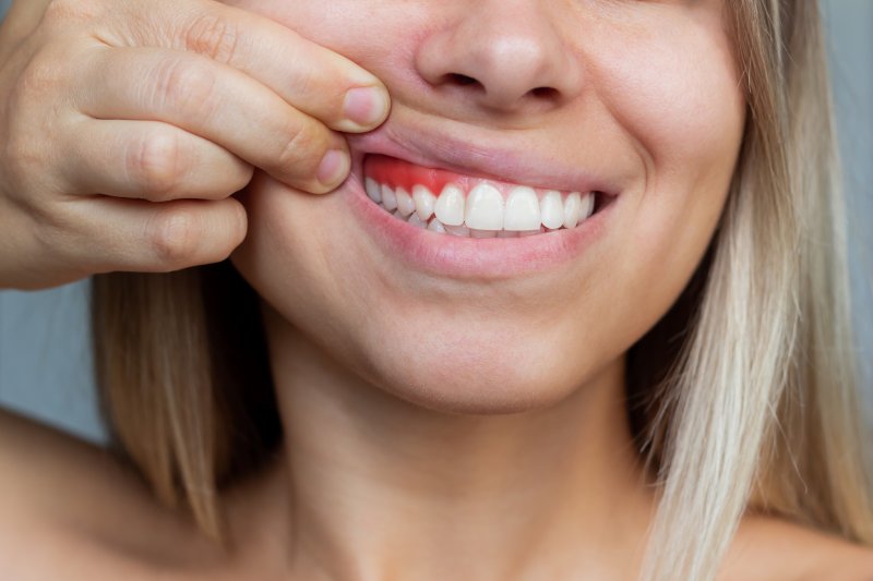 person holding lip up to show gums