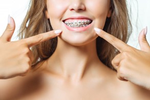 Woman smiling and pointing to her braces.