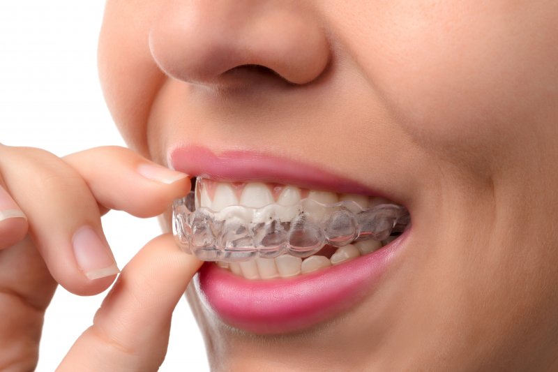 Invisalign trays fixing a patient's bite problems